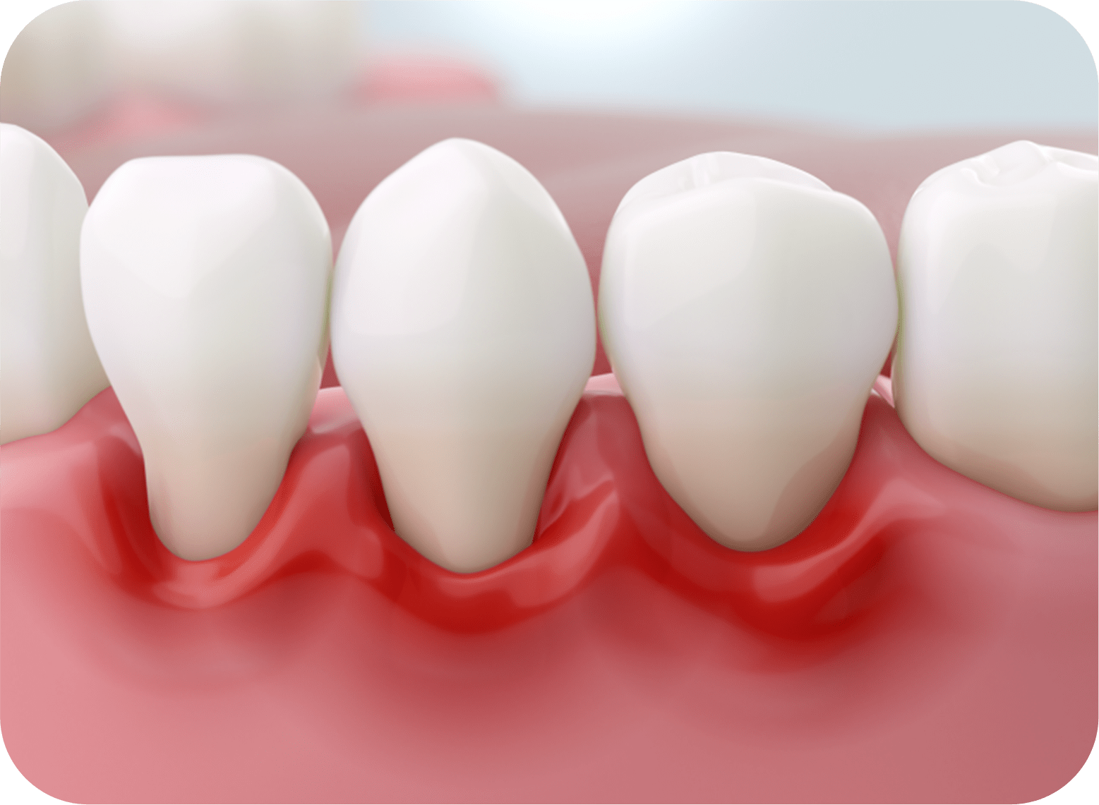 歯茎のイメージ