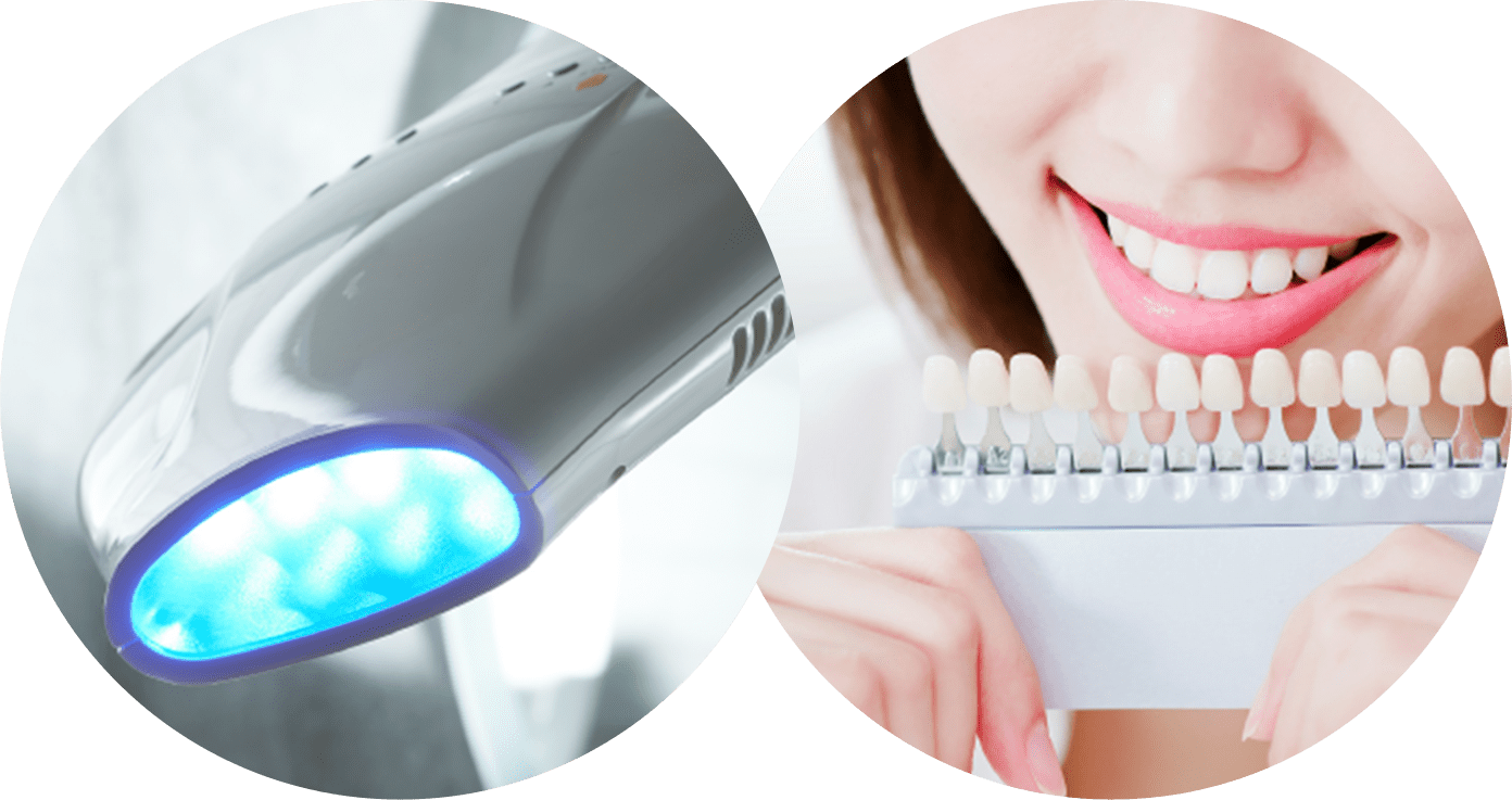 歯科器具と歯の白さを確認する女性の写真